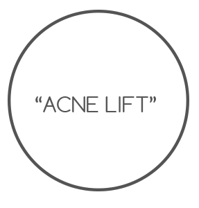 acne-liftpng